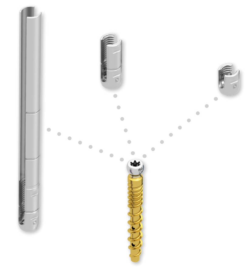 DIPLOMAT® — sistemul: tija din titan, cele trei tulipe interschimbabile (standard, de reducere, percutanată) și șurubul pedicular canulat (render oficial SIGNUS)
