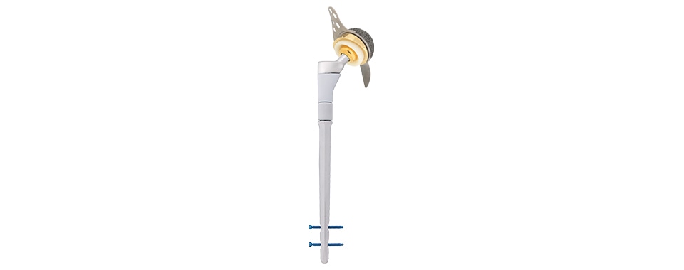 MUTARS® RS — sistem de revizie a șoldului (render oficial Implantcast)