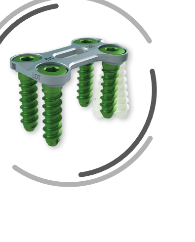 TOSCA® — placă prelordozată ultrasubțire (1,6 mm) cu șuruburi autofiletante codate cromatic (render oficial SIGNUS)