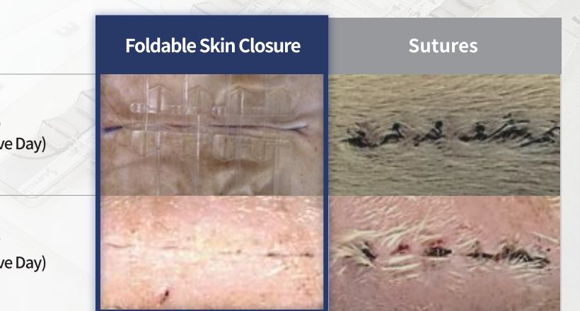 Xkin — comparație Foldable Skin Closure vs. suturi la 0 și 7 zile postoperator: cicatrice și tumefacție reduse (material Surginus)